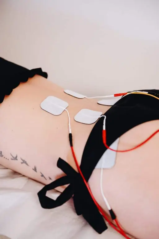Myo activation